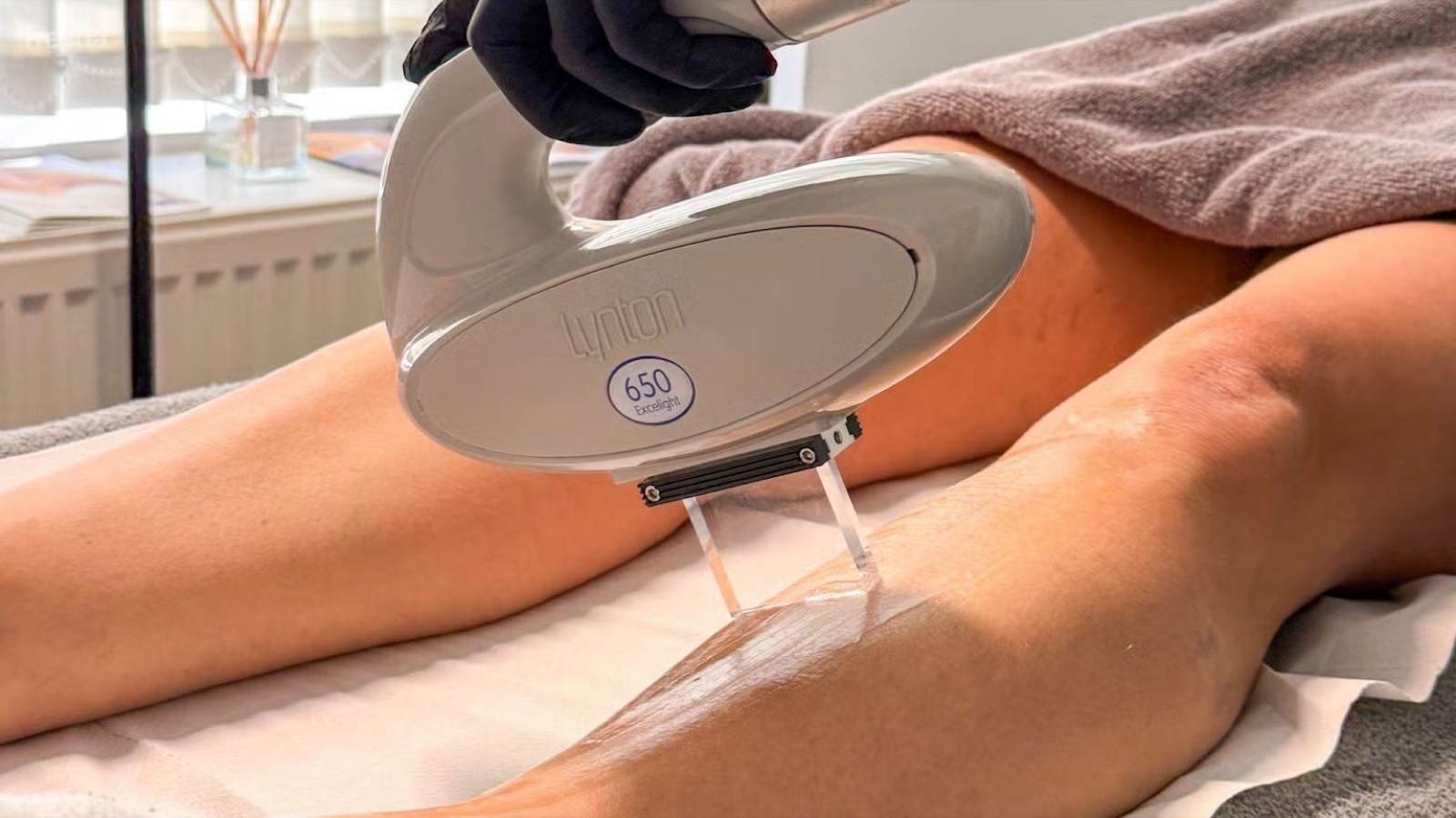 Lynton EXCELIGHT laser hair removal in treatment at the clinic
