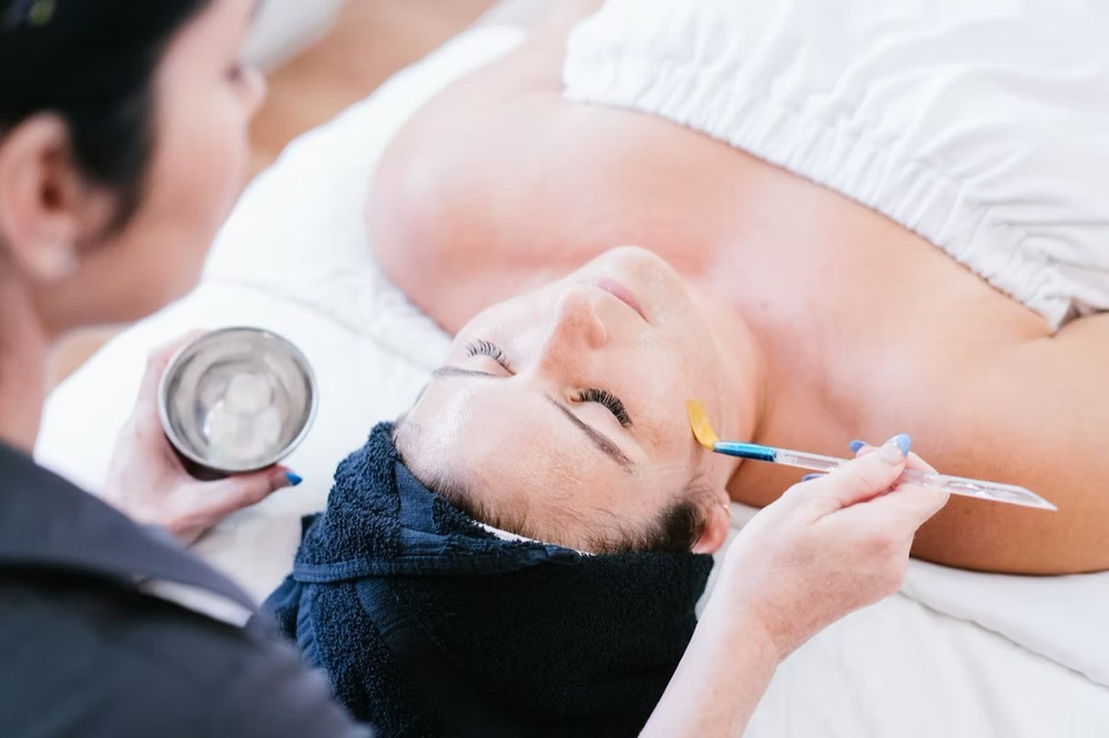 Medical-grade chemical peel treatment